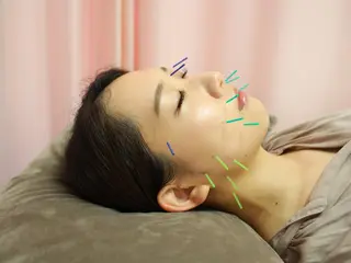 同心整骨院 美容鍼・整体・小顔のエステ・リラクイメージ