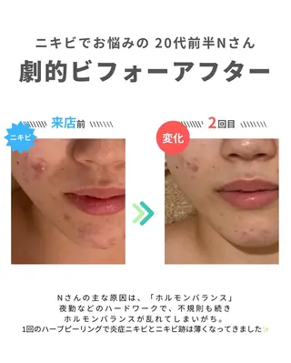 舟橋 優衣のエステ・リラクイメージ