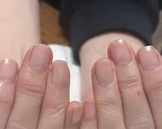 ネイル fote-自爪育成 ネイルケアサロン-のネイルデザイン