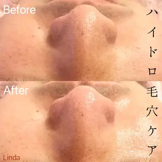 アイラッシュ&エステサロンLinda西宮所属・小顔&毛穴・肌質改善 LINDA西宮 AIのエステ・リラクイメージ