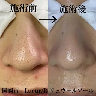 大久保 里奈のエステ・リラクイメージ