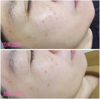 シミケア専門店 HAQUAのその他イメージ