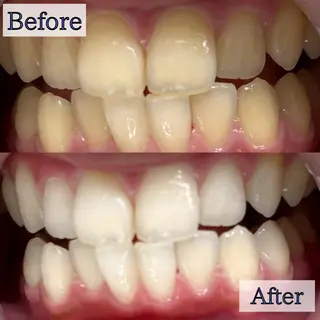 LBSホワイトニング 🌐渋谷店 河内のその他イメージ