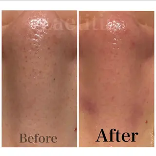 レティティア【Laetitia】所属・レティティア秋葉原店 Yoshizawaのエステ・リラクイメージ