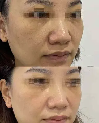 ネイル aliaハイフ&水光ジェットサロン所属・aliaハーブ水光店 エステティシャン募集のエステ・リラクイメージ