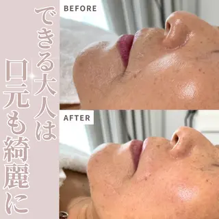 ホワイトワックス名古屋金山店所属・ホワイトワックス 金山店のエステ・リラクイメージ