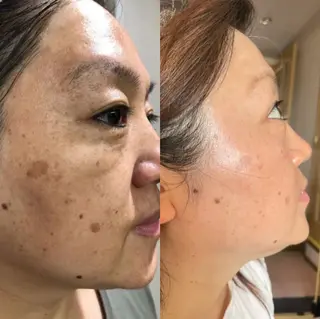 上福岡 らんらんのネイルデザイン