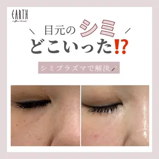 earth龍ヶ崎/ 脱毛/シミ取り🆕のエステ・リラクイメージ