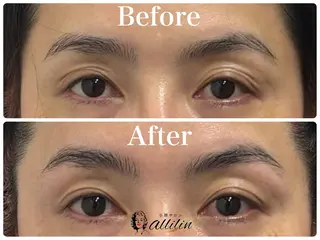 💎小顔ｻﾛﾝ アリリン銀座💎のエステ・リラクイメージ