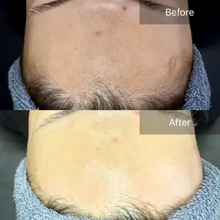 enine所属・enine フェイスWAXのエステ・リラクイメージ