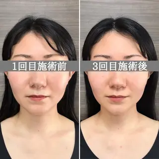 美容整体サロン Chare人形町店のエステ・リラクイメージ