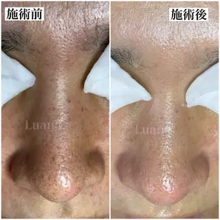 マツヤニWax専門/ 岸和田/Luanaのエステ・リラクイメージ