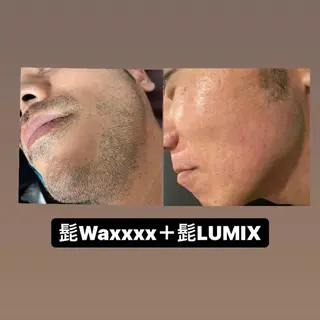 メンズ Epina 千葉店 【エピナ】のエステ・リラクイメージ