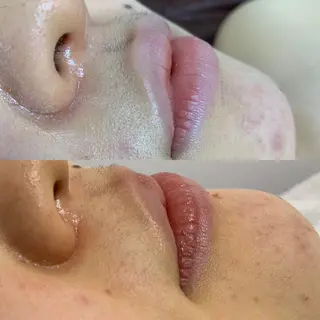 メンズ キッズ 脱毛SALON RaYNiCKのエステ・リラクイメージ