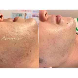 メンズ シードリン 府内店 小波のエステ・リラクイメージ