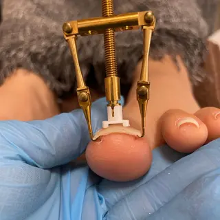 Estotibi エストティビのその他イメージ