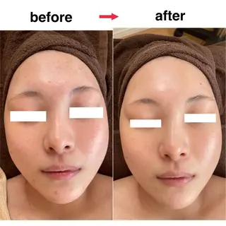 自宅サロン🏠 Nanalaのエステ・リラクイメージ