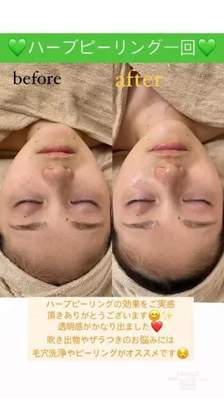 メンズ Salon de Lino 御器所のエステ・リラクイメージ