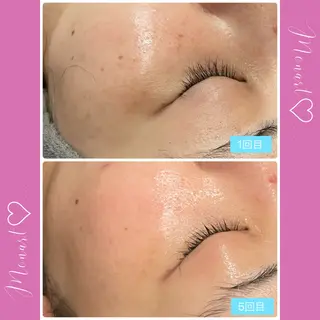 Monart -deux-のエステ・リラクイメージ