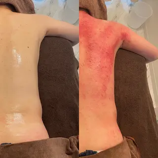 セルフエステエンリケ明石大久保店所属・夕希 毛穴と脱毛特化サロンのエステ・リラクイメージ