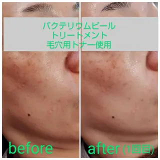 Lottie所属・Lottie リラク担当Asukaのエステ・リラクイメージ