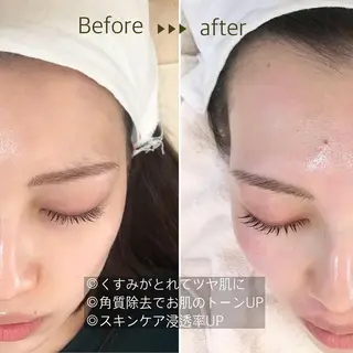 ｉ Ayanaのマツエク・マツパデザイン