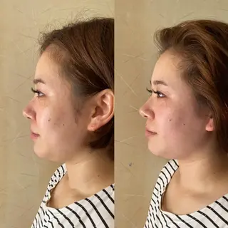 小顔SALON   MAREA所属・MAREA 小顔SALONのエステ・リラクイメージ