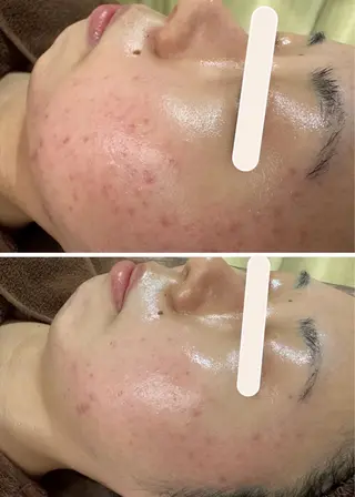 skinity所属・ピーリング専門サロン skinityのエステ・リラクイメージ