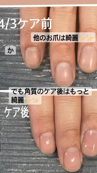 ネイル 奥園 良恵のネイルデザイン