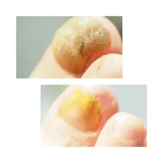 LIZERA&CO（charitesfam内）所属・南古谷　松本 かよのネイルデザイン