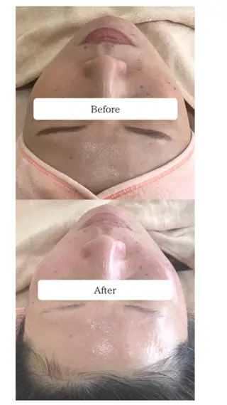 cut・the洒落夢　美肌フェイシャル所属・西本 裕子のエステ・リラクイメージ