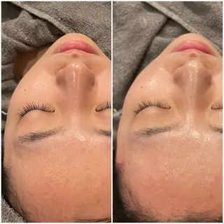 yellow.所属・yellow💛【 脱毛&フェイシャル】のエステ・リラクイメージ