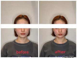 小林整骨院本町 美容鍼roomのエステ・リラクイメージ