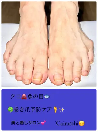 ネイル Tairacchi ﾀｲﾗｯﾁのエステ・リラクイメージ