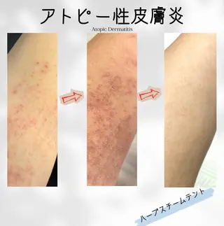 ハーブ蒸しサロン🌿 香嬉琉🌿きよかのエステ・リラクイメージ