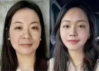 ネイル aliaハイフ&水光ジェットサロン所属・aliaハーブ水光店 エステティシャン募集のエステ・リラクイメージ