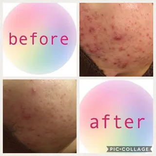 ミディアム カラー パーマ ヘアアレンジ メンズ キッズ ネイル マツエク・マツパ ニキビ・肌質改善専門 ♡人生が変わるサロンのエステ・リラクイメージ