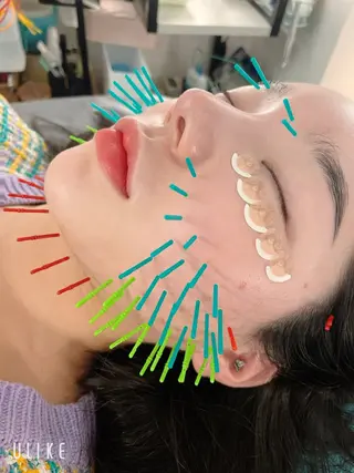 小顔美容鍼専門サロン 渋谷YZのその他イメージ