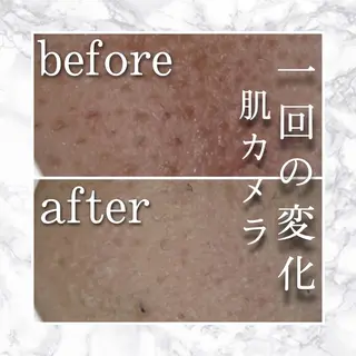 セミロング カラー パーマ ヘアアレンジ メンズ キッズ ネイル マツエク・マツパ アイブロウ ニキビ特化型エステ 🍓最短で肌質改善のエステ・リラクイメージ