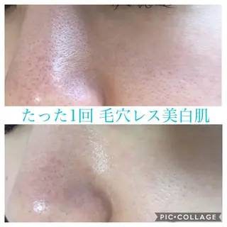 ショート カラー パーマ ヘアアレンジ キッズ ネイル マツエク・マツパ Ensor Clair所属・EnsorClair 代表　野口真央のエステ・リラクイメージ