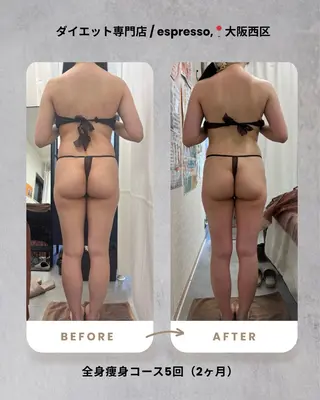 espresso,所属・《痩身、小顔専門店》 エスプレッソのエステ・リラクイメージ