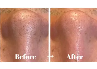 よもぎ蒸しエステサロン★yun所属・よもぎ蒸しサロン ゆんのエステ・リラクイメージ