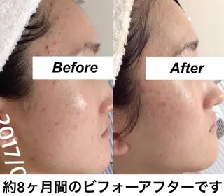 都度払い肌質改善 &脱毛Blancheのエステ・リラクイメージ