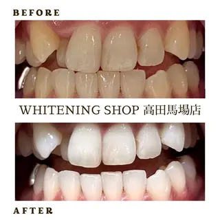 メンズ ホワイトニング ショップ高田馬場店のその他イメージ