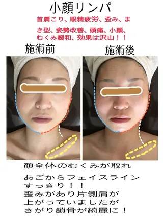 美筋骨格リンパ®️ Aroleのエステ・リラクイメージ