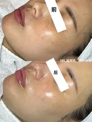 ネイル aliaハイフ&水光ジェットサロン所属・aliaハーブ水光店 エステティシャン募集のエステ・リラクイメージ