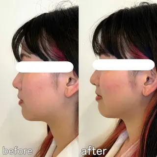 小顔矯正&美容整体 整え屋REDオーナーのエステ・リラクイメージ