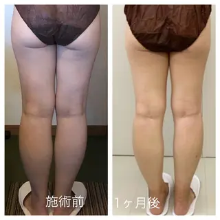 エステサロンhana 加納ゆかのエステ・リラクイメージ