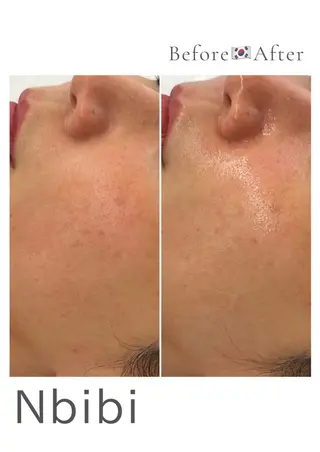 韓国🇰🇷価格 サロン_Nbibiのエステ・リラクイメージ