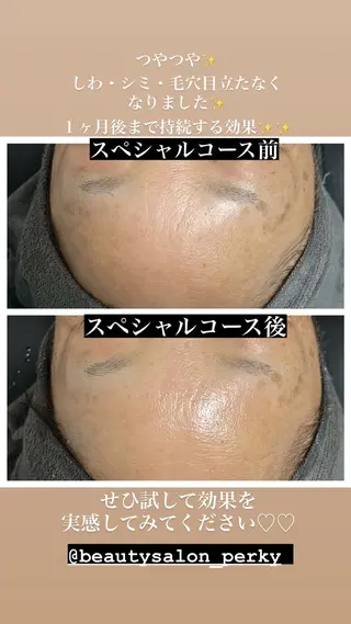 perky所属・perky 羽島のマツエク・マツパデザイン